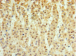 CSB-PA875653ESR1HU