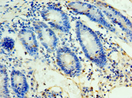 CSB-PA880151ESR1HU