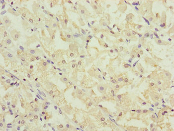 CSB-PA880157ESR1HU