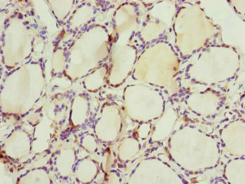 CSB-PA880157ESR1HU