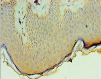 CSB-PA889106ESR1HU