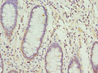 CSB-PA896542ESR1HU
