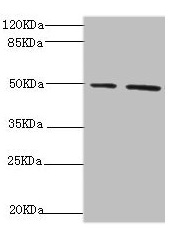 CSB-PA896542ESR1HU