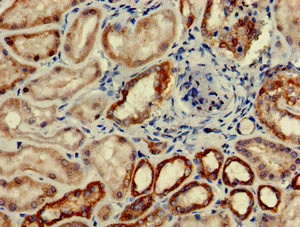 CSB-PA004036LA01HU
