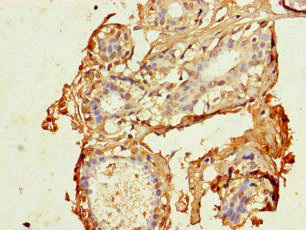 CSB-PA005075LA01HU