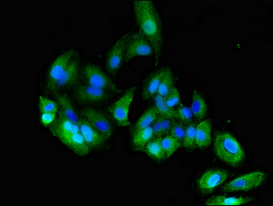 CSB-PA005166LA01HU