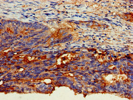 CSB-PA005166LA01HU
