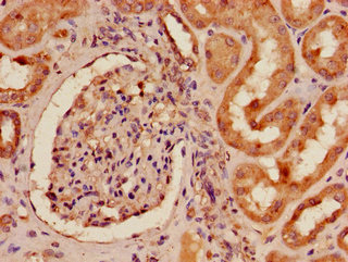 CSB-PA007724LA01HU