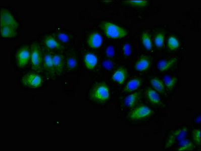 CSB-PA007725LA01HU