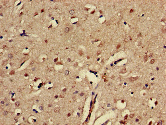 CSB-PA007725LA01HU