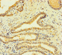 CSB-PA008532LA01HU