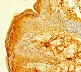 CSB-PA008532LA01HU