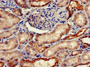 CSB-PA008651LA01HU