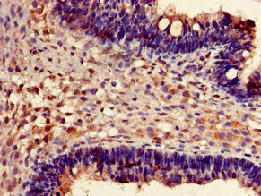 CSB-PA009087LA01HU