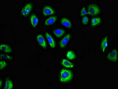 CSB-PA009141LA01HU