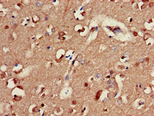 CSB-PA009141LA01HU