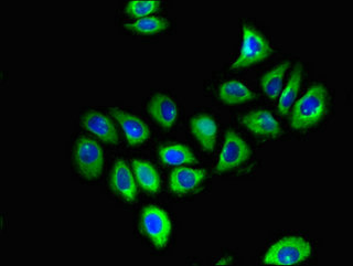 CSB-PA009379LA01HU