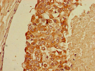 CSB-PA009379LA01HU