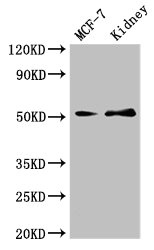 CSB-PA009379LA01HU