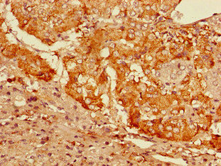 CSB-PA009381LA01HU