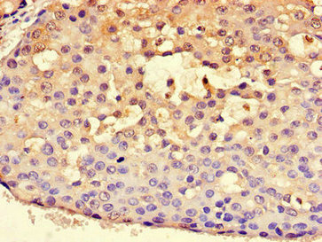 CSB-PA010830HA01HU