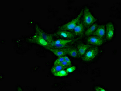 CSB-PA011753LA01HU
