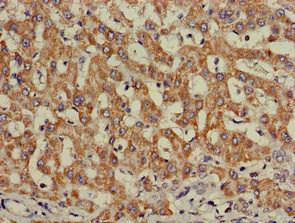 CSB-PA011753LA01HU