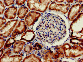 CSB-PA011753LA01HU
