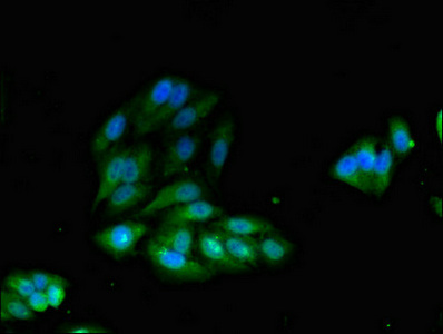 CSB-PA011830LA01HU