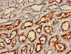 CSB-PA011830LA01HU