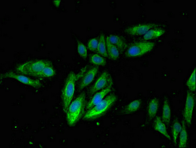 CSB-PA011884LA01HU