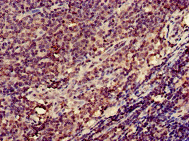 CSB-PA011884LA01HU