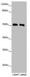 CSB-PA013611LA01HU
