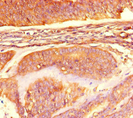 CSB-PA013633HA01HU