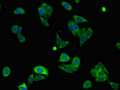 CSB-PA015871LA01HU
