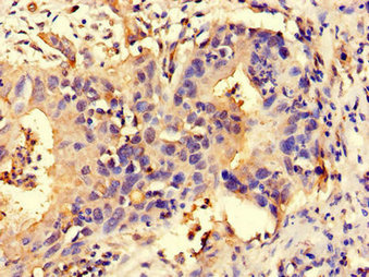 CSB-PA015871LA01HU
