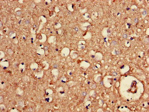 CSB-PA016070LA01HU