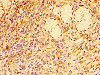 CSB-PA019219LA01HU