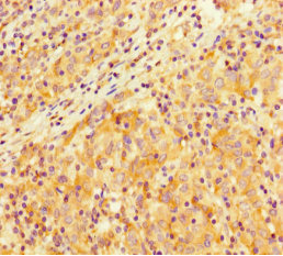 CSB-PA021801LA01HU