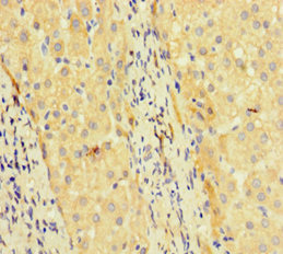 CSB-PA023302HA01HU