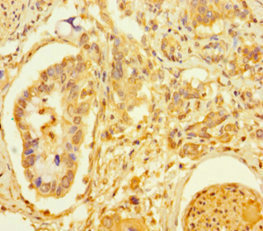 CSB-PA023302HA01HU