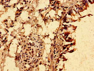 CSB-PA024457LA01HU