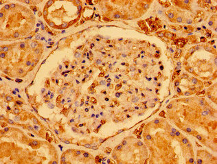 CSB-PA406800LA01HU