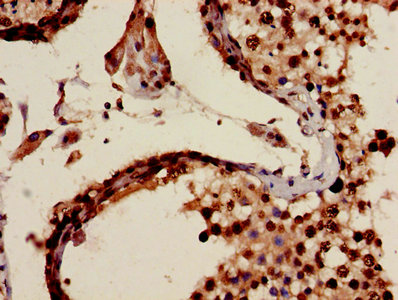 CSB-PA613694LA01HU