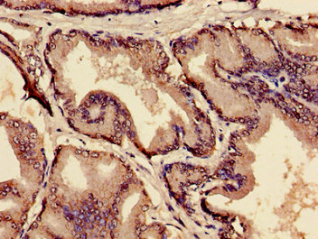 CSB-PA613694LA01HU