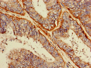 CSB-PA619859LA01HU
