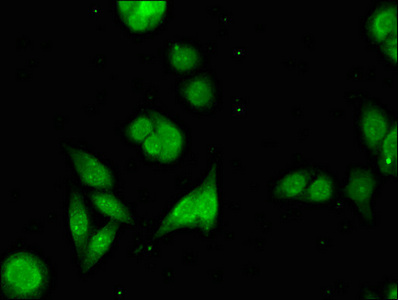 CSB-PA773045LA01HU
