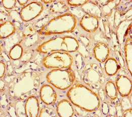 CSB-PA852915HA01HU