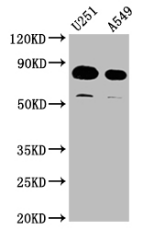 CSB-PA875720LA01HU