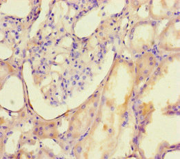 CSB-PA883358HA01HU